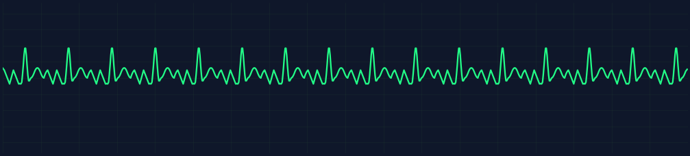 Atrial Flutter