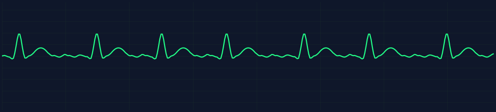 AFib